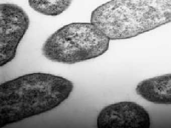   Stenotrophomonas maltophilia.   