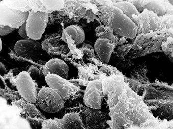 Yersinia pestis.  Rocky Mountain Laboratories, NIAID, NIH